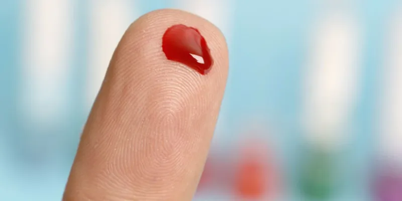 Nằm mơ thấy máu – Ý nghĩa và con số may mắn để thử vận may 4 Danh sách các con số may mắn khi nằm mơ thấy máu